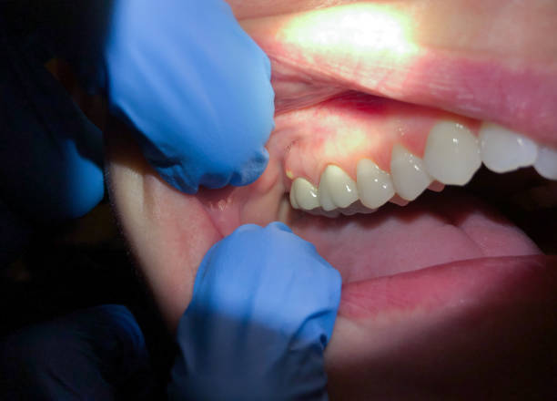 Best Orthodontic Emergency Dentist in Glenwood, IA