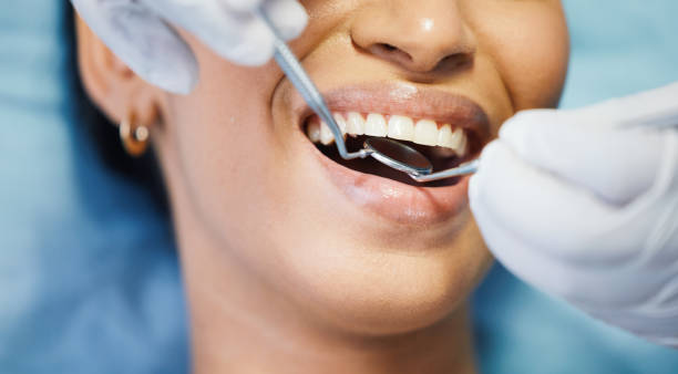 Best Emergency Root Canal Treatment in Glenwood, IA