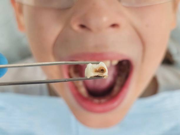 Best Urgent Dental Care for Toothache in Glenwood, IA